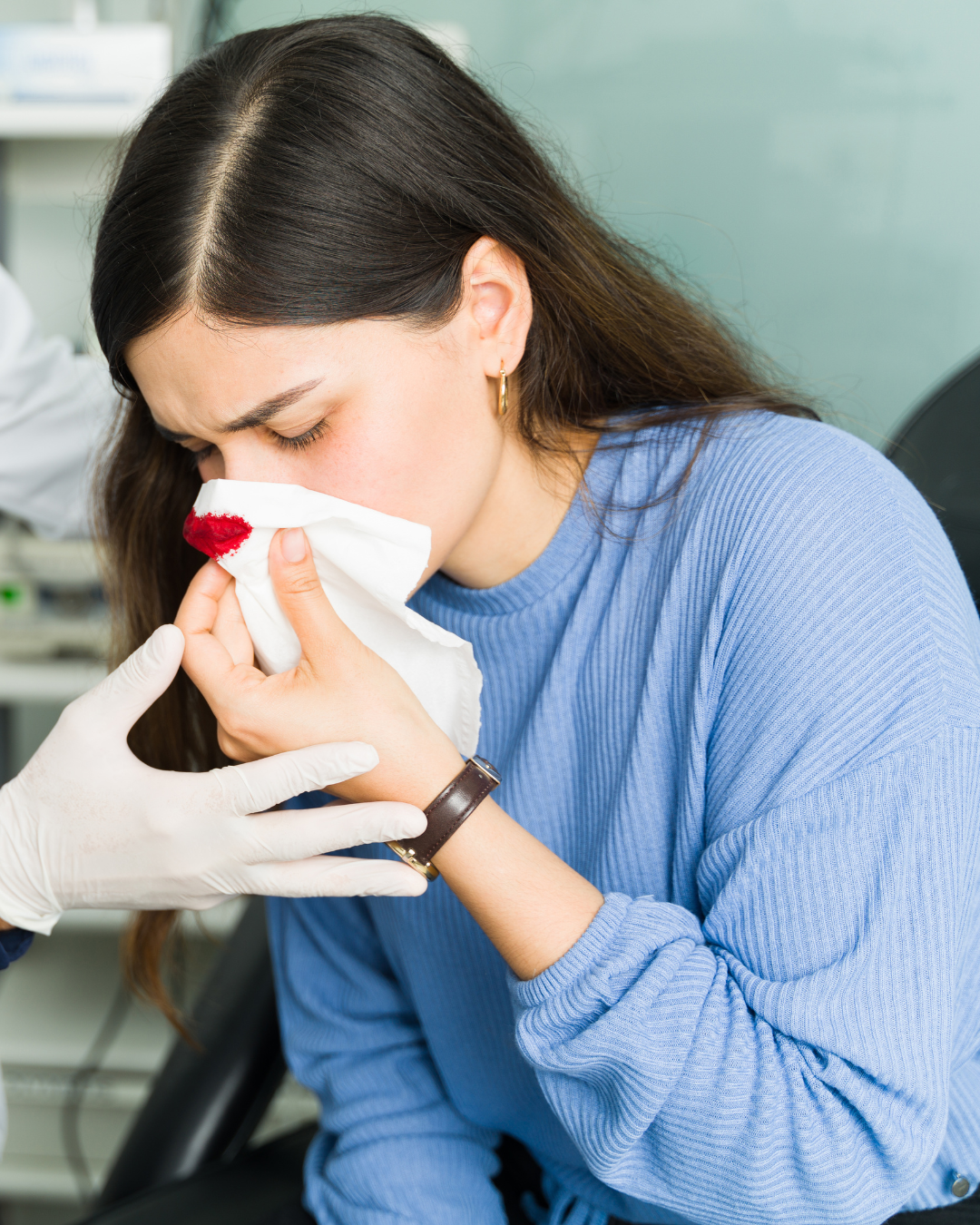 υποτροπιάζουσες ρινορραγίες woman with nose bleed