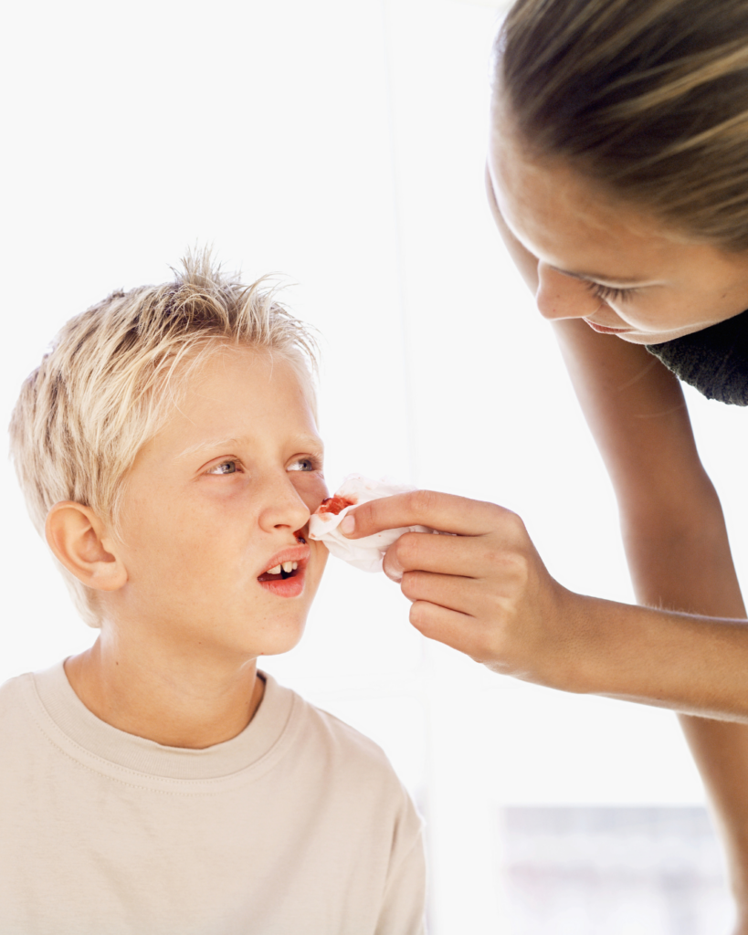  αιμορραγία από τη μύτη σε παιδιά mum helping child with nose bleed